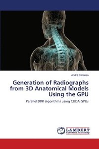 bokomslag Generation of Radiographs from 3D Anatomical Models Using the GPU