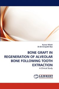 bokomslag Bone Graft in Regeneration of Alveolar Bone Following Tooth Extraction