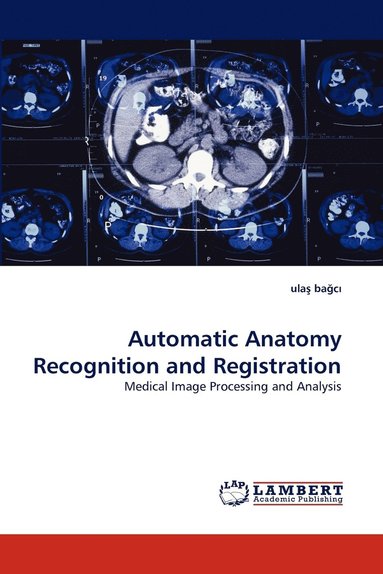 bokomslag Automatic Anatomy Recognition and Registration