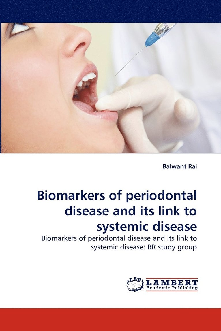 Biomarkers of periodontal disease and its link to systemic disease 1