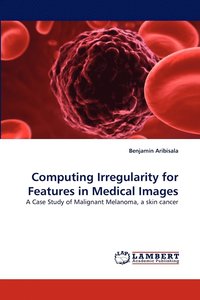 bokomslag Computing Irregularity for Features in Medical Images