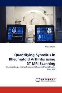 bokomslag Quantifying Synovitis in Rheumatoid Arthritis using 3T MRI Scanning