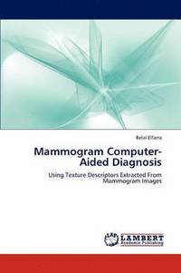 bokomslag Mammogram Computer-Aided Diagnosis