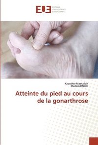 bokomslag Atteinte du pied au cours de la gonarthrose