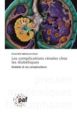 bokomslag Les complications rénales chez les diabétiques