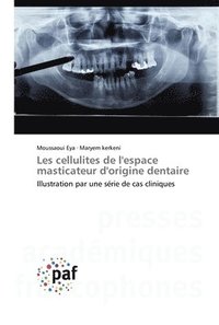 bokomslag Les cellulites de l'espace masticateur d'origine dentaire