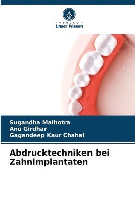 Sugandha Malhotra, Anu Girdhar, Gagandeep Kaur Chahal - Abdrucktechniken bei Zahnimplantaten, Häftad
