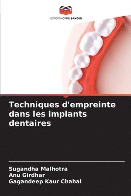 Sugandha Malhotra, Anu Girdhar, Gagandeep Kaur Chahal - Techniques d'empreinte dans les implants dentaires, Häftad