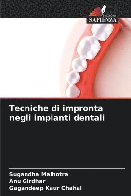 Sugandha Malhotra, Anu Girdhar, Gagandeep Kaur Chahal - Tecniche di impronta negli impianti dentali, Häftad