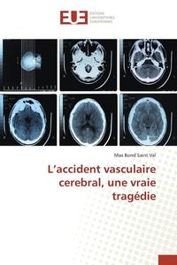 bokomslag L'Accident Vasculaire Cerebral, Une Vraie Tragdie