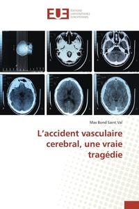 bokomslag L'Accident Vasculaire Cerebral, Une Vraie Tragedie