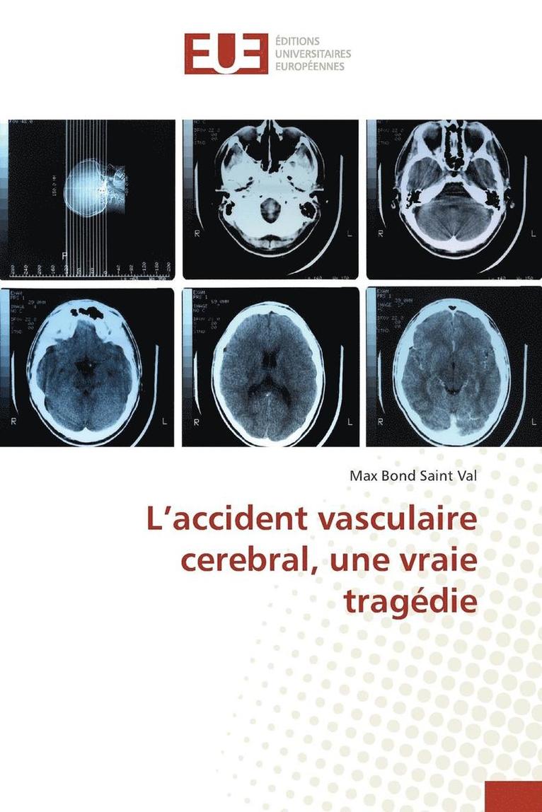 L'Accident Vasculaire Cerebral, Une Vraie Tragdie 1