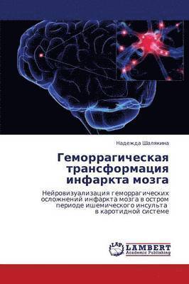 bokomslag Gemorragicheskaya Transformatsiya Infarkta Mozga