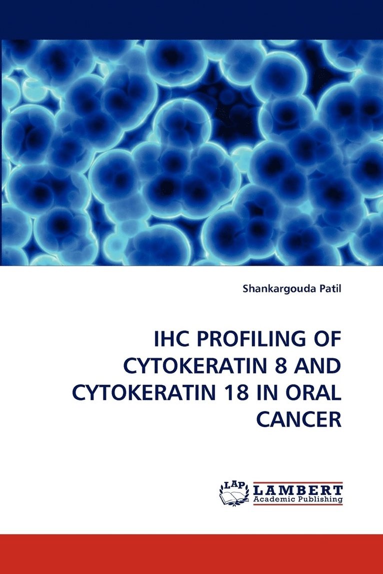 Ihc Profiling of Cytokeratin 8 and Cytokeratin 18 in Oral Cancer 1