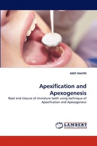 bokomslag Apexification and Apexogenesis