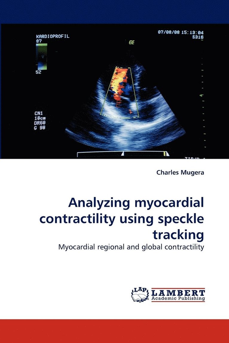 Analyzing Myocardial Contractility Using Speckle Tracking 1