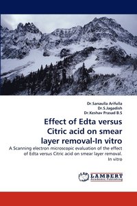 bokomslag Effect of Edta Versus Citric Acid on Smear Layer Removal-In Vitro