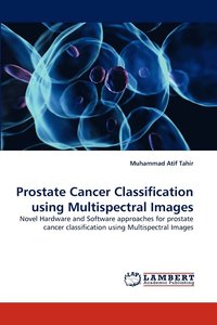 bokomslag Prostate Cancer Classification using Multispectral Images