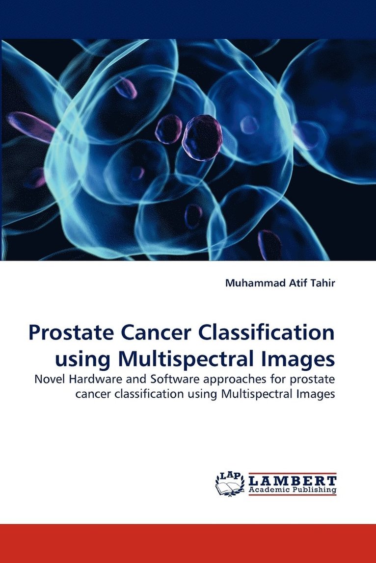 Prostate Cancer Classification using Multispectral Images 1