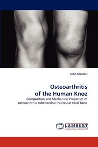 bokomslag Osteoarthritis of the Human Knee