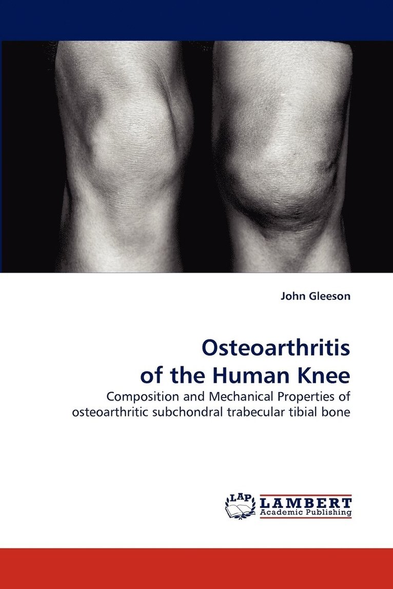 Osteoarthritis of the Human Knee 1