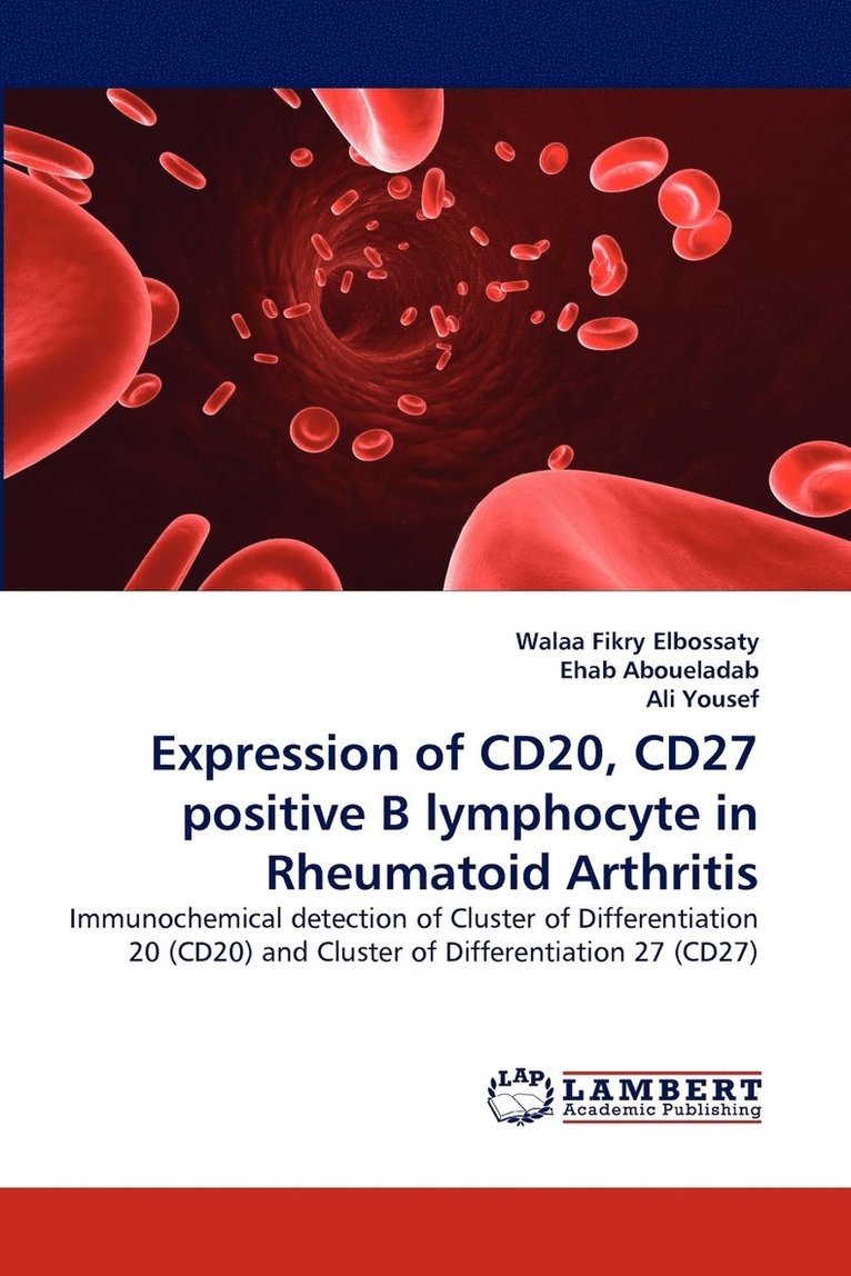 Expression of CD20, CD27 positive B lymphocyte in Rheumatoid Arthritis 1