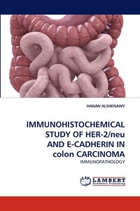 bokomslag IMMUNOHISTOCHEMICAL STUDY OF HER-2/neu AND E-CADHERIN IN colon CARCINOMA