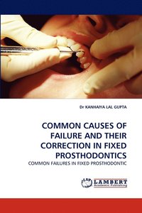 bokomslag Common Causes of Failure and Their Correction in Fixed Prosthodontics