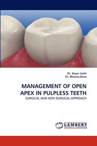 bokomslag Management of Open Apex in Pulpless Teeth