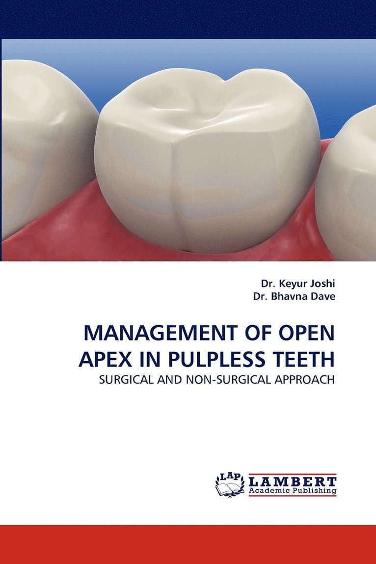 Management of Open Apex in Pulpless Teeth 1