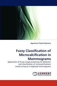 bokomslag Fuzzy Classification of Microcalcification in Mammograms
