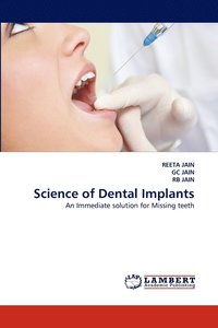 bokomslag Science of Dental Implants
