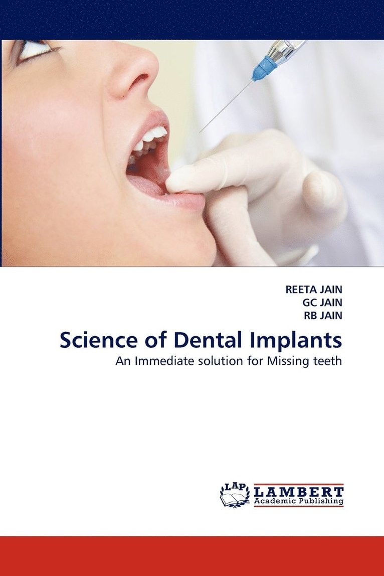 Science of Dental Implants 1
