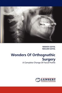 bokomslag Wonders Of Orthognathic Surgery