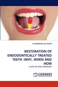 bokomslag Restoration of Endodontically Treated Teeth