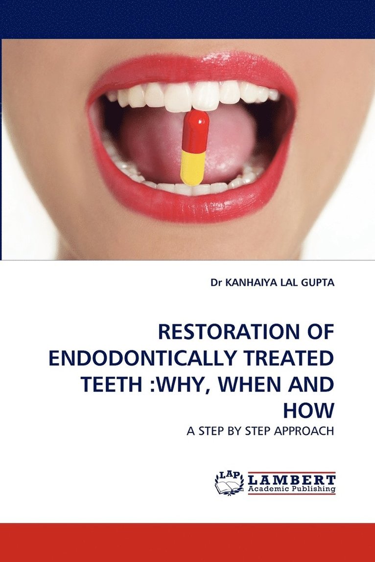 Restoration of Endodontically Treated Teeth 1