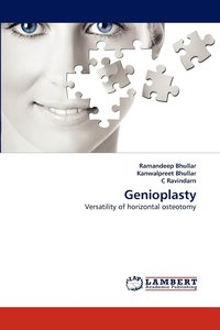 bokomslag Genioplasty