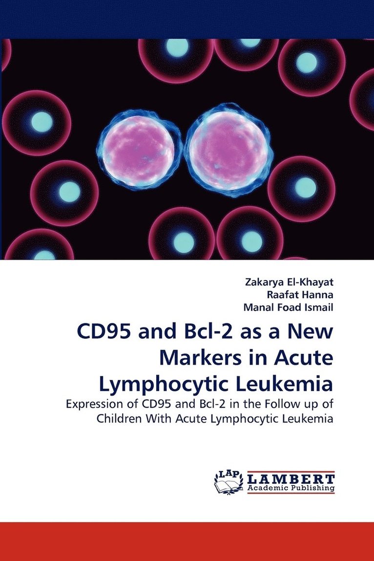 Cd95 and Bcl-2 as a New Markers in Acute Lymphocytic Leukemia 1
