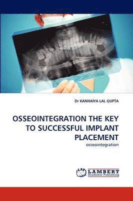 Osseointegration the Key to Successful Implant Placement 1