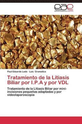 bokomslag Tratamiento de la Litiasis Biliar por I.P.A y por VDL