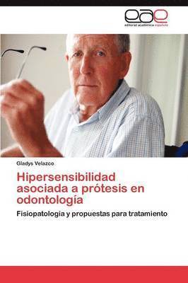 Hipersensibilidad asociada a prtesis en odontologa 1