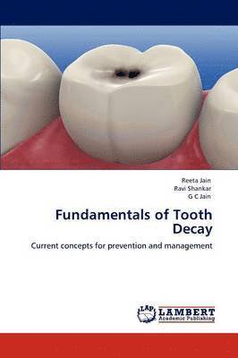 Fundamentals of Tooth Decay 1