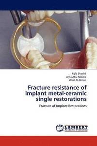 bokomslag Fracture Resistance of Implant Metal-Ceramic Single Restorations
