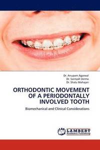 bokomslag Orthodontic Movement of a Periodontally Involved Tooth
