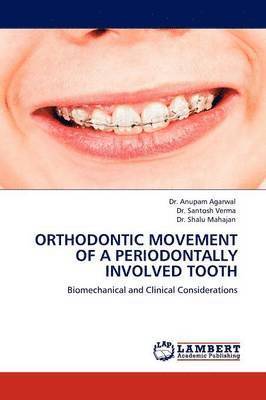 Orthodontic Movement of a Periodontally Involved Tooth 1