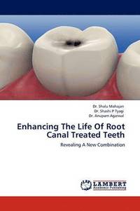 bokomslag Enhancing The Life Of Root Canal Treated Teeth