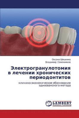 Elektrogranulotomiya V Lechenii Khronicheskikh Periodontitov 1