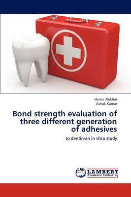 bokomslag Bond Strength Evaluation of Three Different Generation of Adhesives