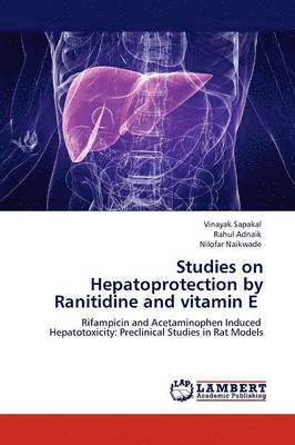 Studies on Hepatoprotection by Ranitidine and Vitamin E 1