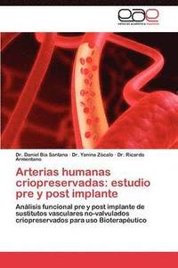 bokomslag Arterias humanas criopreservadas